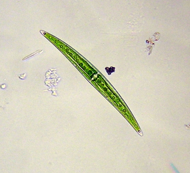 Closterium sp.